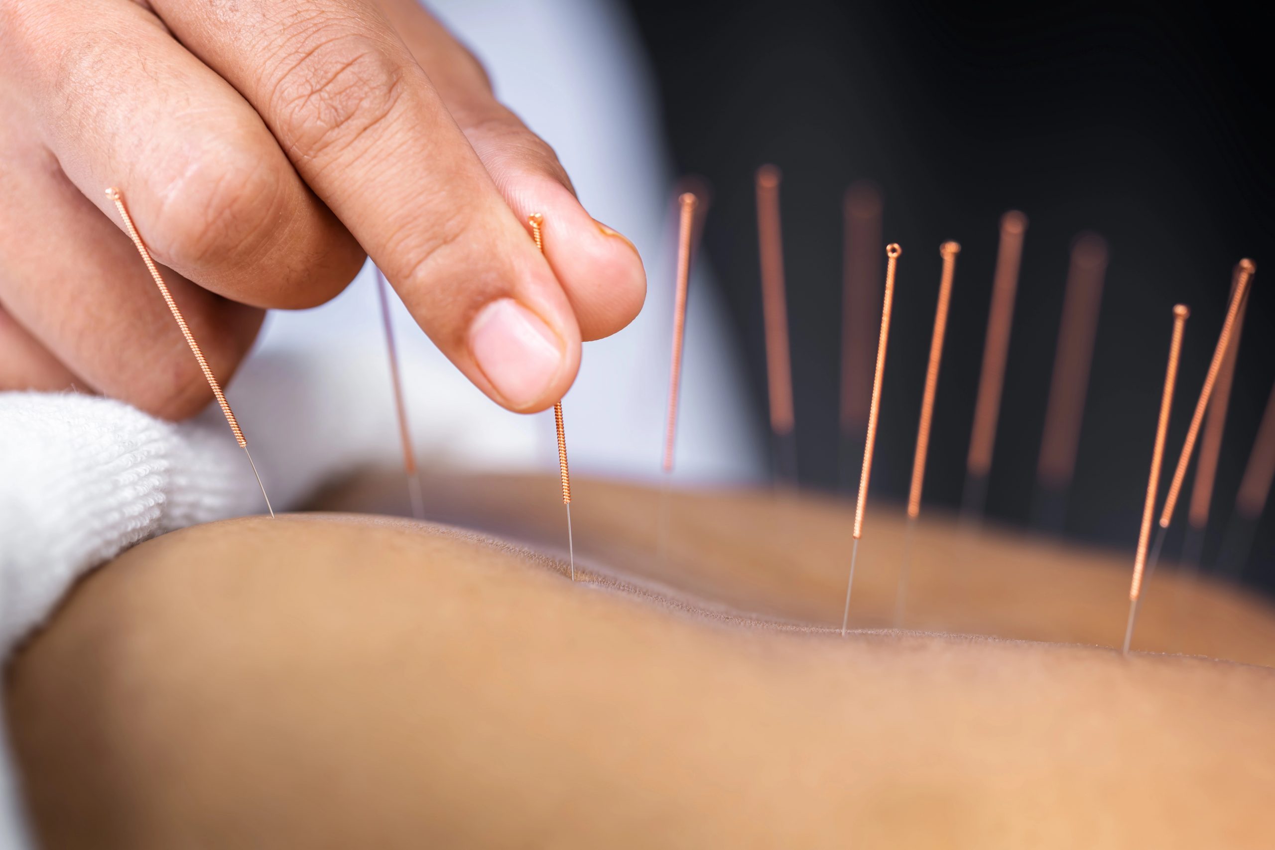 Willow Wellness Physiotherapy Acupuncture Massage Therapy Clinic | Langley BC